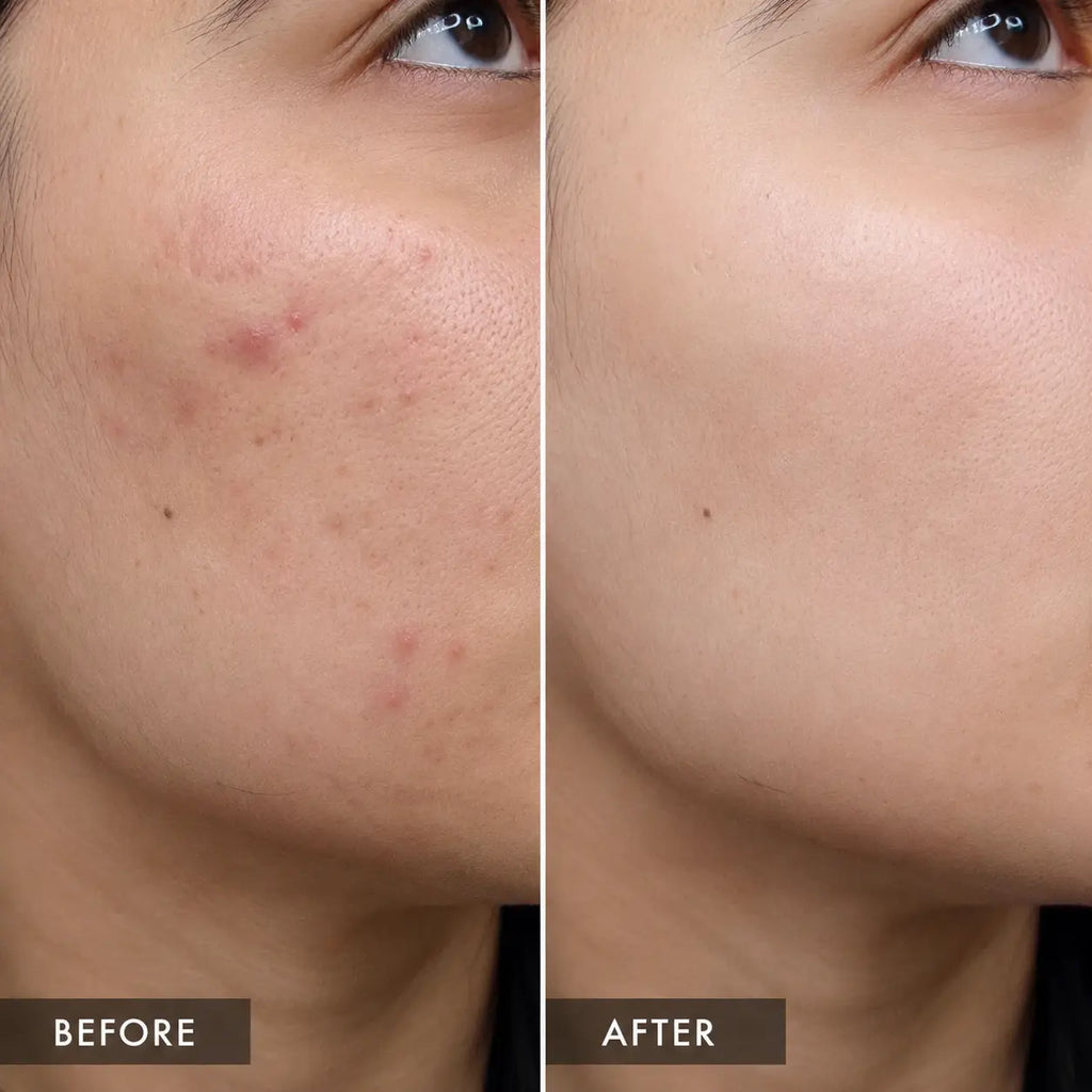 NiaChem Serum