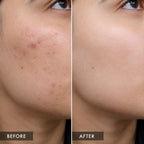 NiaChem Serum